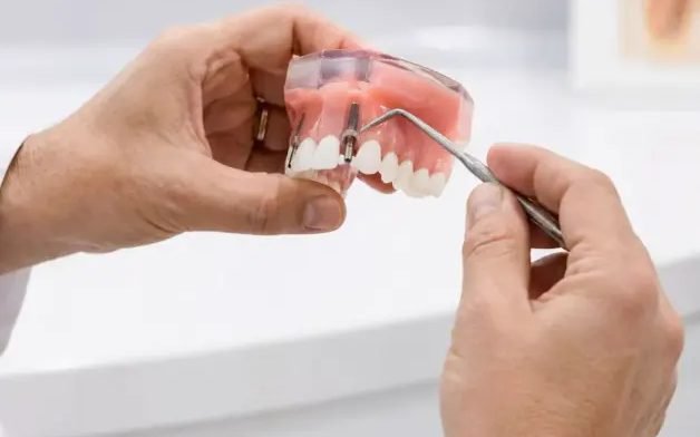Prótesis dental removible sostenida en la mano